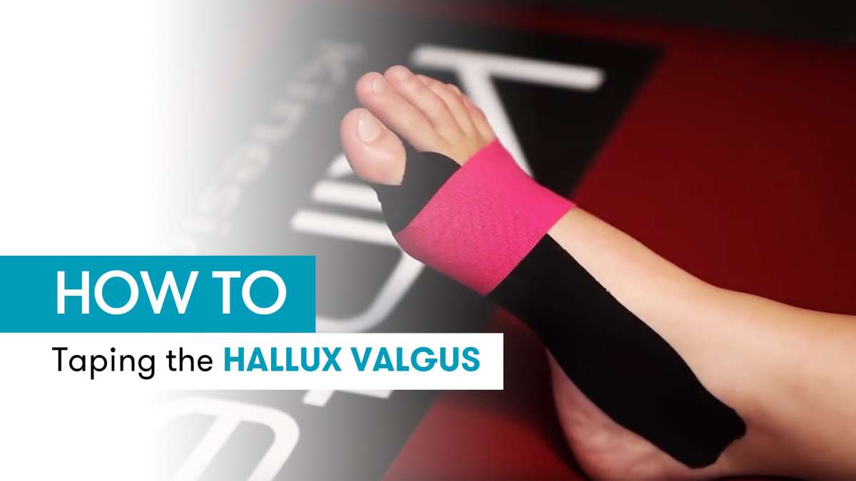 Instruction for Kinesiology Tape the Hallux Valgus