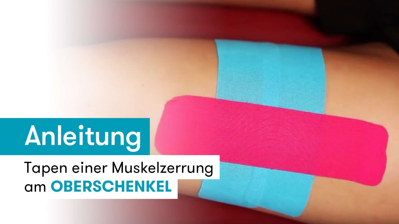 Was Hilft Gegen Zerrung Im Oberschenkel