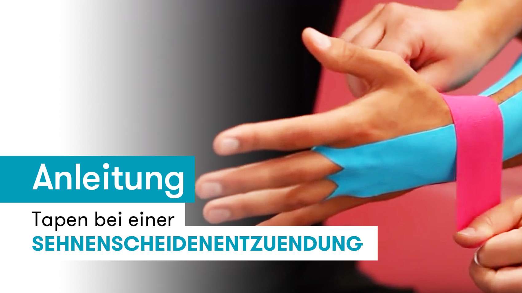 Sehnenscheidenentzündung tapen Anleitung mit Video
